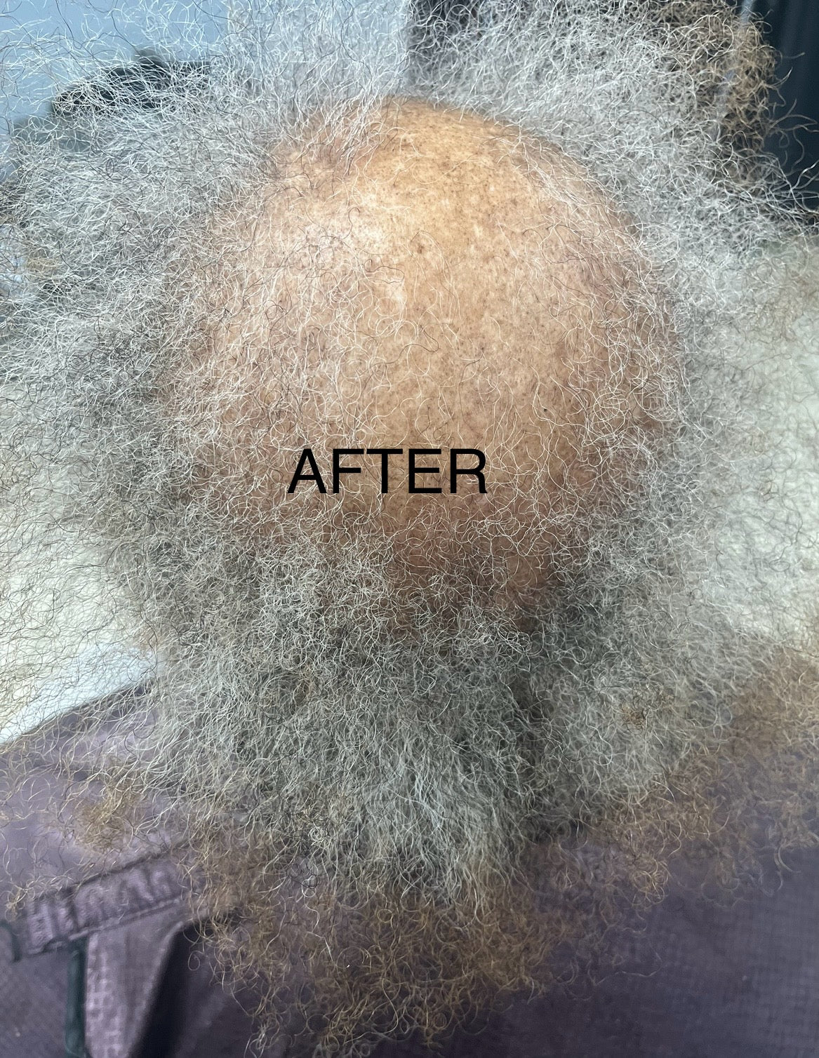 More Hair Therapy Solution-Extra Strength