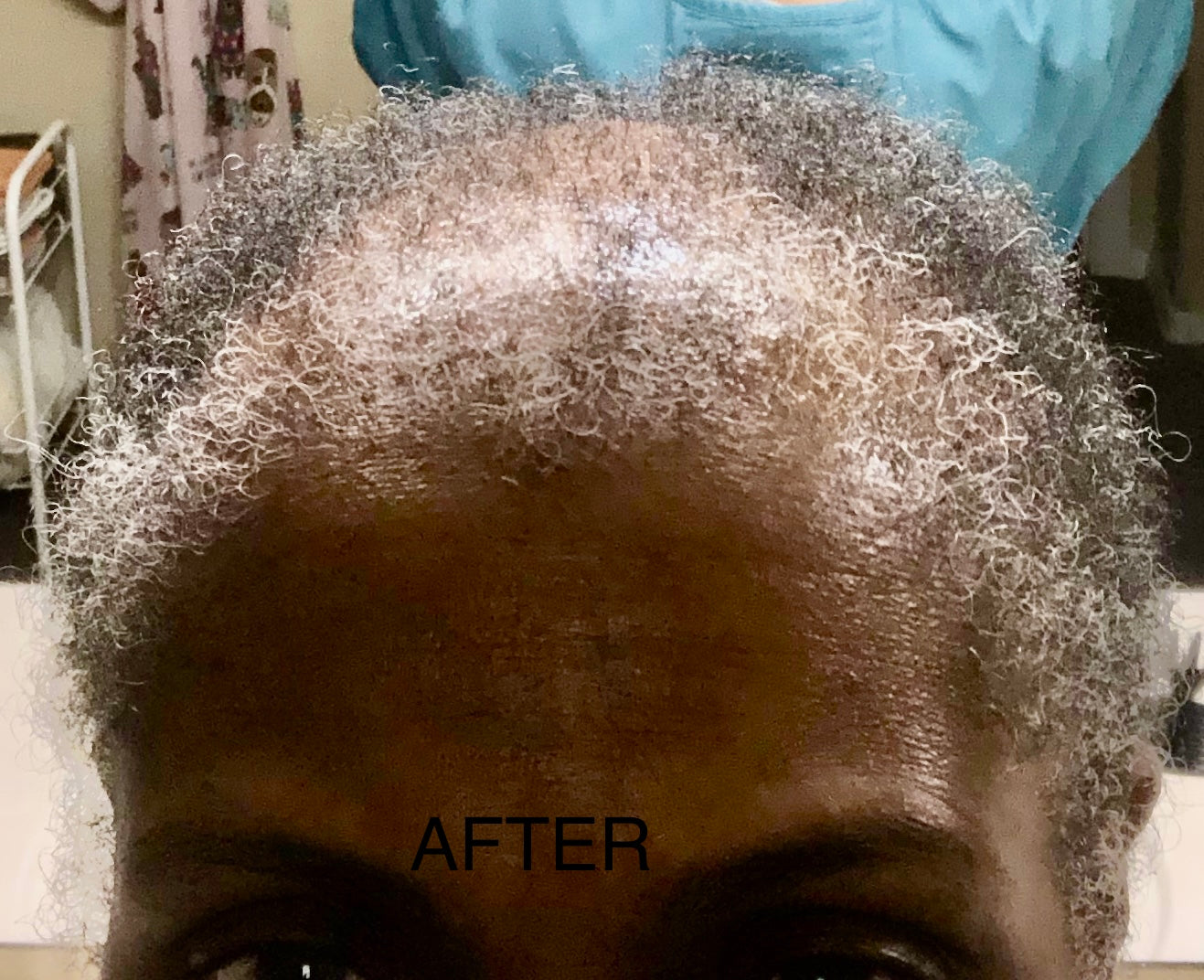 More Hair Therapy Solution